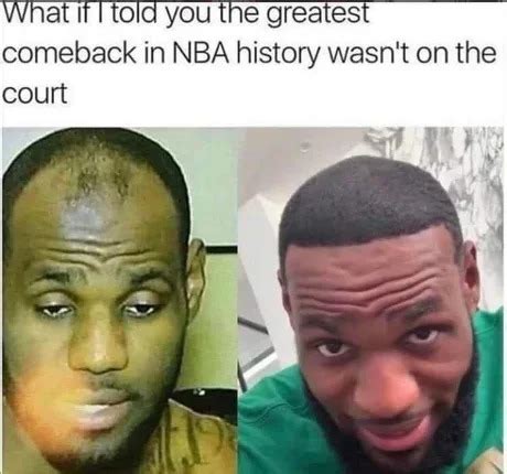 The best Hairline memes :) Memedroid