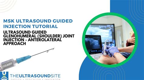 Ultrasound Guided Injection