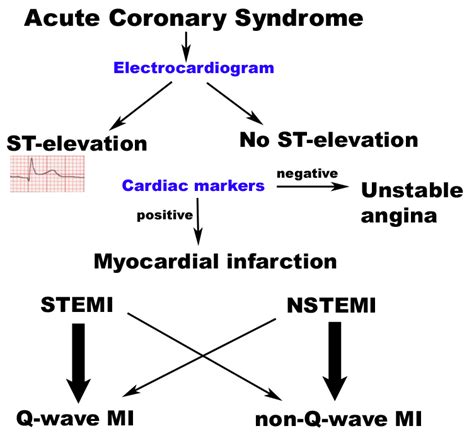 Acute Coronary Artery Syndrome | Cardiac Health