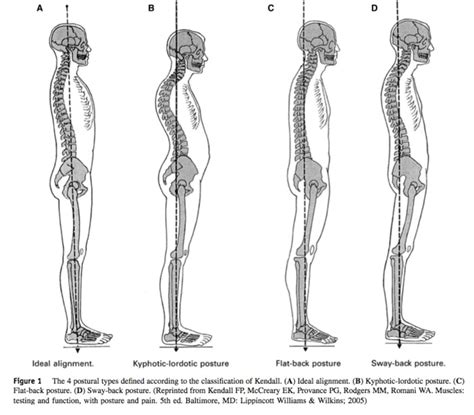 Check the types of posture. What type do you have? - Matthew D. Hepler