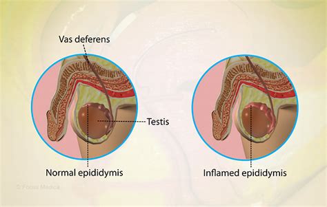 Health Condition : Symptoms, Causes, Treatment and More