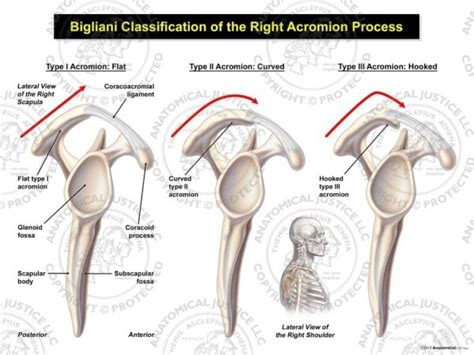 Bigliani Classification of the Right Acromion Process