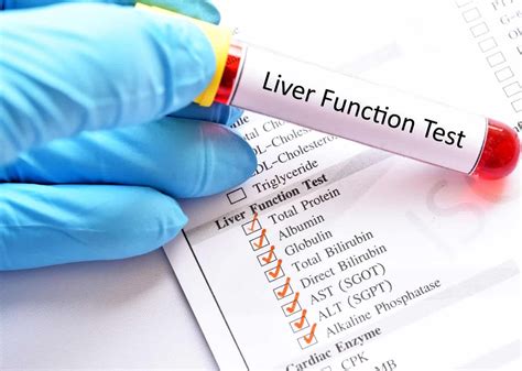 Liver function test: What is it and what does it reveal?