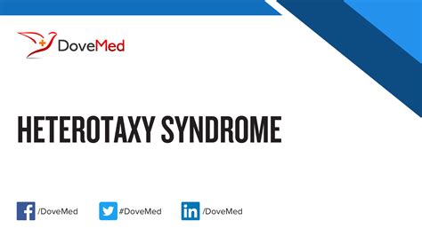 Heterotaxy Syndrome