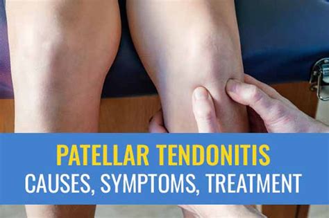 Patellar tendonitis - Causes, symptoms, and treatment