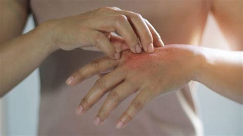Skin Rashes: The problem of rashes on the skin? Choose Simple Ayurveda Treatment