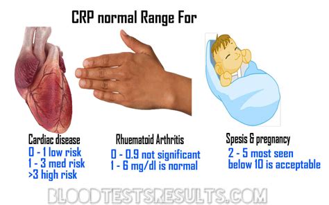 What is CRP Normal Range (rapid and Hs c-reactive protein normal range)? – Blood Test Results ...