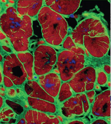 Stem Cell Roundup: watching brain cells in real time, building better heart cells, and the plot ...