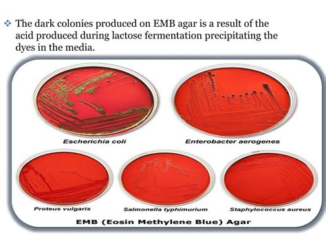 Eosin Methylene Blue Agar Results - dailyscoopsofpecansweets