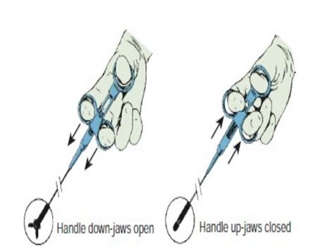 Endomyocardial Biopsy