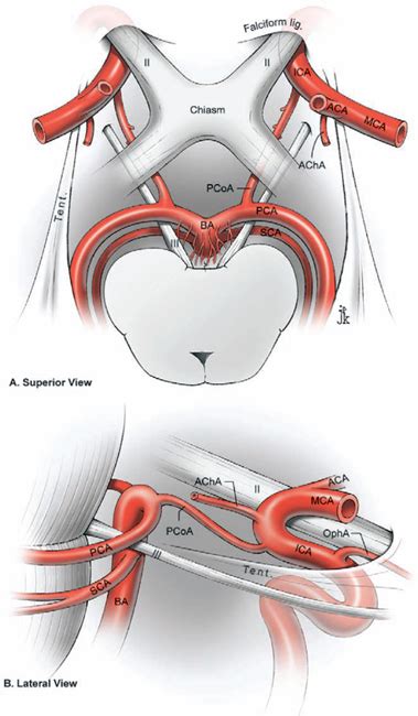 Posterior Communicating Artery Anatomyzone | The Best Porn Website