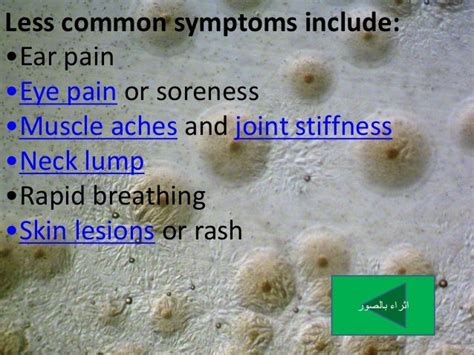 Mycoplasma pneumonia