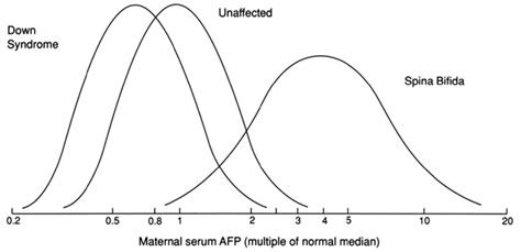 Fetal Neural Tube Defects: Diagnosis, Management, and Treatment | GLOWM