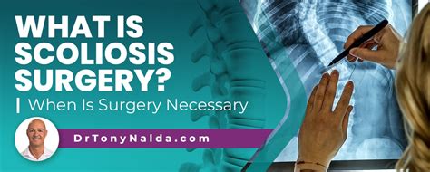 What is Scoliosis Surgery? When Is Surgery Necessary?