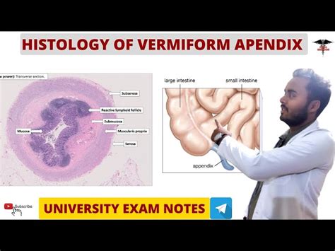 Vermiform Appendix Histology