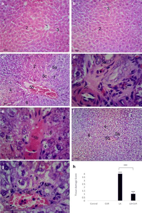 Hepatic histopathology. a The micrograph shows normal hepatic tissue... | Download Scientific ...