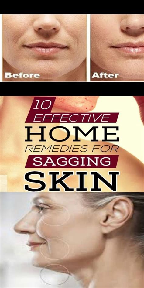 Effective Home Remedies For Skin Tightening | Home remedies for skin, Skin tightening, Skin ...