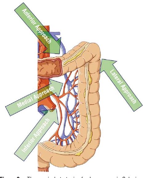 [PDF] Laparoscopic Mobilization of the Splenic Flexure as the First ...