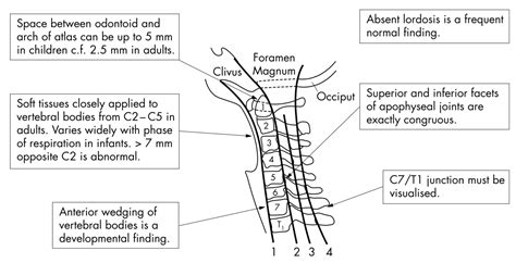 C-spine x-ray interpretation