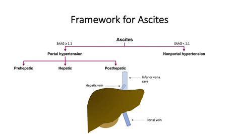 Differential Diagnosis of Ascites - YouTube