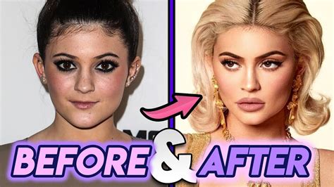 Å! 27+ Grunner til Kylie Jenner Before: Her face shape is slightly ...