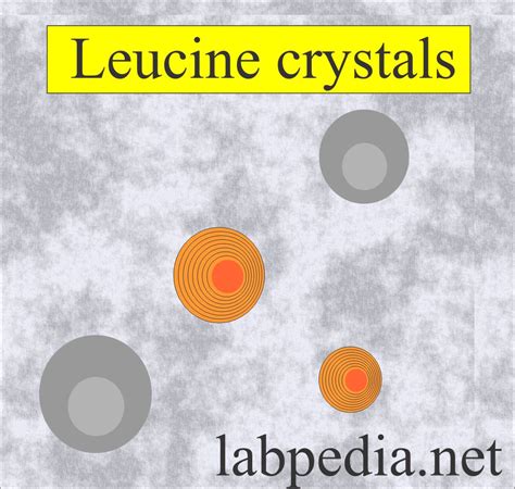 Urine Crystals (Crystalluria) - Labpedia.net