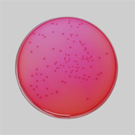 XLD Agar Xylose Lysine Deoxycholate Agar Microbiology, 57% OFF