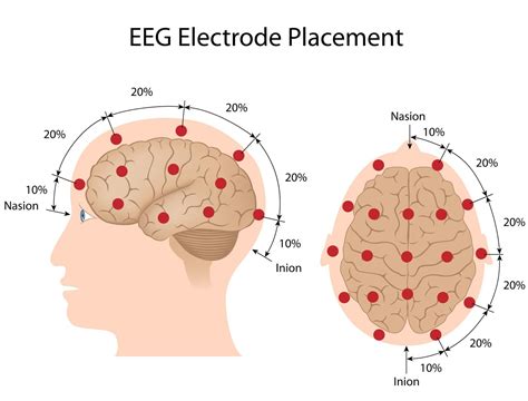 ASET Department of Education Report