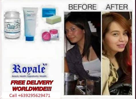 Royale Glutathione Users Before And After Photos