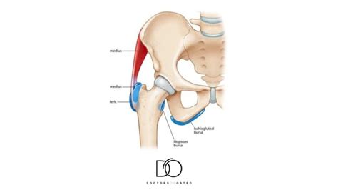 Greater Trochanteric Bursitis & Ischial Gluteal Bursitis (What is Bursitis?) — Osteopath Hawthorn