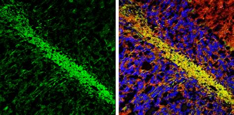 Anti-MAG antibody (GTX114542) | GeneTex