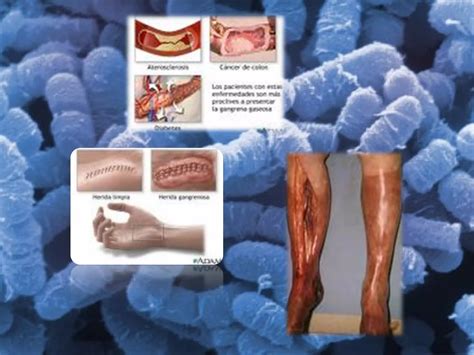 Clostridium perfringens, taxonomía y enfermedades