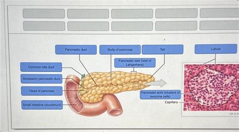 Solved Common bile duct Accessory pancreatic duct Head of | Chegg.com