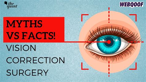 Myths And Facts Around Vision Correction Surgeries