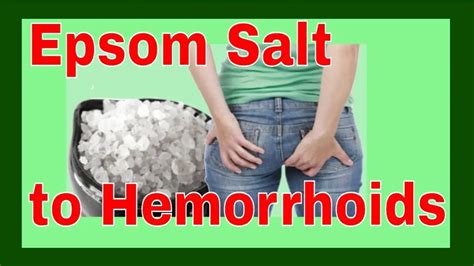 Hemorrhoids Treatment | How to Use Epsom Salt to Relieve Hemorrhoids - The Natural Cure