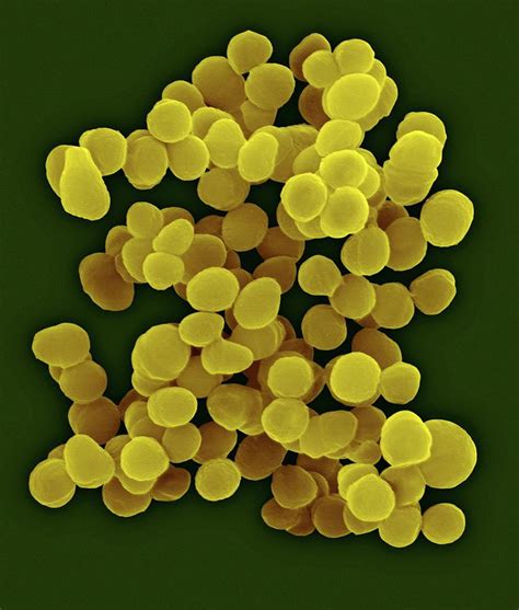 Aerococcus Urinaeequi Photograph by Dennis Kunkel Microscopy/science Photo Library