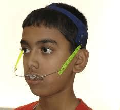 Orthodontic headgear | News | Dentagama