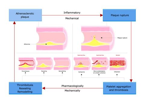 Dynamic Pathophysiology – RCEMLearning India