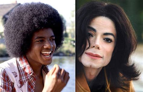 The Unforgettable Michael Jackson Before and After Plastic Surgery ...