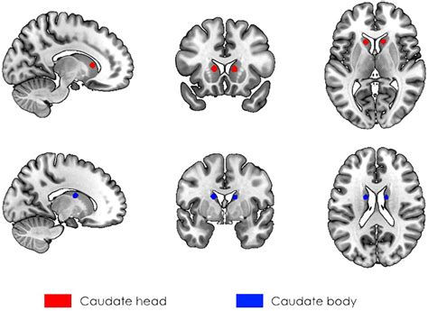 Frontiers | The Interaction Between Caudate Nucleus and Regions Within the Theory of Mind ...