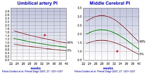 Growth and Doppler ultrasound – Maternal Fetal Medicine