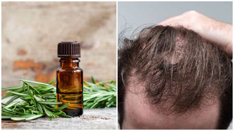 The Rosemary Oil Hair Loss Challenge: Is It Really Effective?