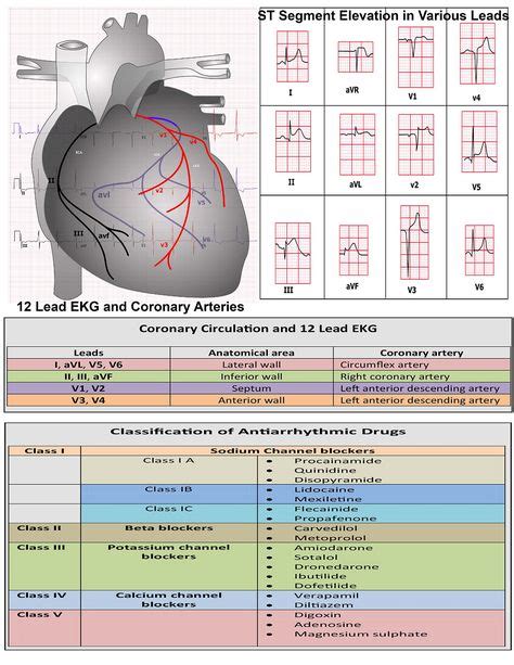 12-lead ekg interpretation - Google Search | Ekg interpretation, Ekg, Emergency nursing