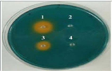 Detection of siderophores | Download Scientific Diagram