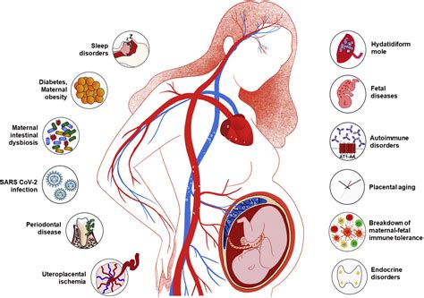 All about preeclampsia during pregnancy