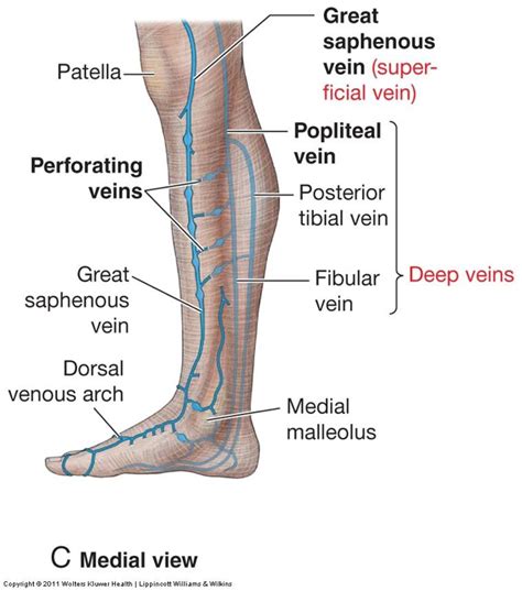 Varicose veins - Their cause,symptoms and cure.