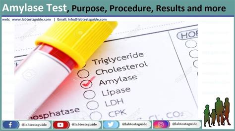 Amylase (Serum) Test Purpose, Procedure, Result and more | Lab Tests Guide