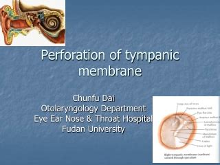 Tympanic membrane rupture PowerPoint (PPT) Presentations, Tympanic ...