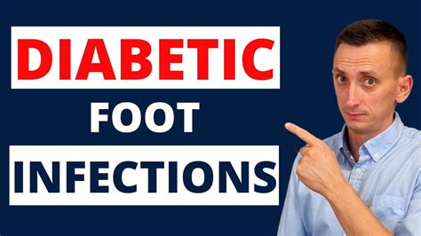 Worst Infections! (Diabetic Foot) - Diabetes