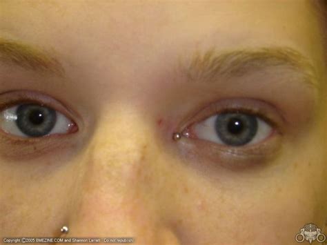 Hit of the Day! Piercing on eyelid (17 pics)